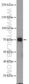 Probable ATP-dependent RNA helicase DDX41 antibody, 27500-1-AP, Proteintech Group, Western Blot image 