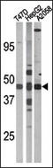 E2F-1 antibody, AP12602PU-N, Origene, Western Blot image 