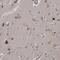 Kelch Domain Containing 3 antibody, HPA030134, Atlas Antibodies, Immunohistochemistry frozen image 