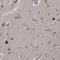 Kelch Domain Containing 3 antibody, HPA030134, Atlas Antibodies, Immunohistochemistry frozen image 