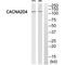 Calcium Voltage-Gated Channel Auxiliary Subunit Alpha2delta 4 antibody, A09975, Boster Biological Technology, Western Blot image 