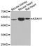 Acid ceramidase antibody, abx005006, Abbexa, Western Blot image 