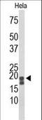 Acid Phosphatase antibody, LS-C155961, Lifespan Biosciences, Western Blot image 