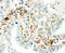 Transglutaminase 2 antibody, LS-C313264, Lifespan Biosciences, Immunohistochemistry paraffin image 