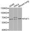 PHD finger protein 1 antibody, A8450, ABclonal Technology, Western Blot image 