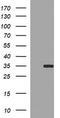 Snail Family Transcriptional Repressor 1 antibody, LS-C174780, Lifespan Biosciences, Western Blot image 