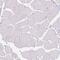 CCCTC-Binding Factor Like antibody, NBP1-89947, Novus Biologicals, Immunohistochemistry paraffin image 