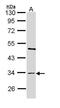 Bone Marrow Stromal Cell Antigen 1 antibody, GTX112704, GeneTex, Western Blot image 