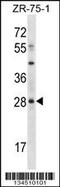 Msh Homeobox 2 antibody, 57-906, ProSci, Western Blot image 