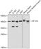 Hypoxia Inducible Factor 1 Subunit Alpha Inhibitor antibody, 19-681, ProSci, Western Blot image 