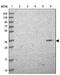 Formyl Peptide Receptor 1 antibody, NBP2-47452, Novus Biologicals, Western Blot image 