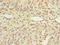 GrpE Like 1, Mitochondrial antibody, LS-C675836, Lifespan Biosciences, Immunohistochemistry paraffin image 