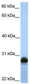 Sialic acid-binding Ig-like lectin 12 antibody, TA342056, Origene, Western Blot image 
