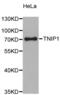 TNFAIP3 Interacting Protein 1 antibody, MBS128699, MyBioSource, Western Blot image 