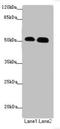 ATM Interactor antibody, LS-C675395, Lifespan Biosciences, Western Blot image 