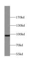 Synaptotagmin 11 antibody, FNab08426, FineTest, Western Blot image 