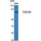 Transforming Growth Factor Beta Receptor 2 antibody, LS-C386403, Lifespan Biosciences, Western Blot image 