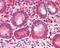 Bromodomain Adjacent To Zinc Finger Domain 2B antibody, GTX89680, GeneTex, Immunohistochemistry paraffin image 
