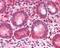 Bromodomain Adjacent To Zinc Finger Domain 2B antibody, GTX89680, GeneTex, Immunohistochemistry paraffin image 