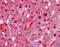 Fumarylacetoacetate Hydrolase antibody, ARP41680_P050, Aviva Systems Biology, Immunohistochemistry paraffin image 