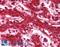 Chloride Intracellular Channel 1 antibody, LS-B4303, Lifespan Biosciences, Immunohistochemistry paraffin image 