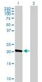 Nucleoside-Triphosphatase, Cancer-Related antibody, H00084284-B01P, Novus Biologicals, Western Blot image 