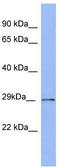 Proteasome Subunit Alpha 5 antibody, TA342161, Origene, Western Blot image 