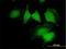 Calponin 2 antibody, H00001265-B01P, Novus Biologicals, Immunofluorescence image 