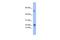 Phospholipase A2 Group V antibody, GTX47160, GeneTex, Western Blot image 