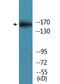 Glutamate Ionotropic Receptor NMDA Type Subunit 2B antibody, LS-C291579, Lifespan Biosciences, Western Blot image 