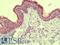 Membrane Spanning 4-Domains A6A antibody, LS-B9586, Lifespan Biosciences, Immunohistochemistry paraffin image 