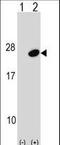 Ubiquitin Conjugating Enzyme E2 G1 antibody, LS-C157310, Lifespan Biosciences, Western Blot image 