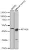 Activin A Receptor Type 1B antibody, GTX32991, GeneTex, Western Blot image 