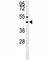 Suppressor Of Variegation 3-9 Homolog 1 antibody, F41774-0.4ML, NSJ Bioreagents, Western Blot image 