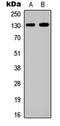 EPH Receptor A2 antibody, orb256516, Biorbyt, Western Blot image 