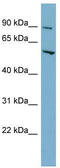 Major Facilitator Superfamily Domain Containing 1 antibody, TA338612, Origene, Western Blot image 