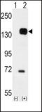 TEK Receptor Tyrosine Kinase antibody, MBS9205459, MyBioSource, Western Blot image 