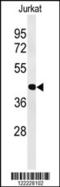 Activating Transcription Factor 1 antibody, 61-688, ProSci, Western Blot image 