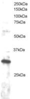 Dickkopf WNT Signaling Pathway Inhibitor 4 antibody, LS-C54725, Lifespan Biosciences, Western Blot image 