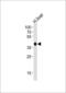 Hydroxyacid Oxidase 1 antibody, GTX81144, GeneTex, Western Blot image 