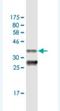 Peroxisomal Biogenesis Factor 3 antibody, H00008504-M04, Novus Biologicals, Western Blot image 