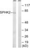 Sphingosine Kinase 2 antibody, LS-C118372, Lifespan Biosciences, Western Blot image 