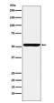 NUF2 Component Of NDC80 Kinetochore Complex antibody, M03788-1, Boster Biological Technology, Western Blot image 