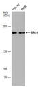 SWI/SNF Related, Matrix Associated, Actin Dependent Regulator Of Chromatin, Subfamily A, Member 4 antibody, GTX633391, GeneTex, Western Blot image 