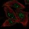 Ubiquitin Conjugating Enzyme E2 O antibody, NBP2-13501, Novus Biologicals, Immunofluorescence image 