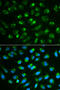 Interleukin 7 antibody, STJ24191, St John