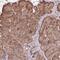 ASK-1 antibody, NBP2-57164, Novus Biologicals, Immunohistochemistry paraffin image 