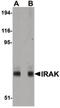 Interleukin 1 Receptor Associated Kinase 1 antibody, MA5-15783, Invitrogen Antibodies, Western Blot image 