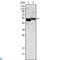 Alpha-1-antitrypsin antibody, LS-C812486, Lifespan Biosciences, Western Blot image 