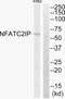 Nuclear Factor Of Activated T Cells 2 Interacting Protein antibody, PA5-38119, Invitrogen Antibodies, Western Blot image 